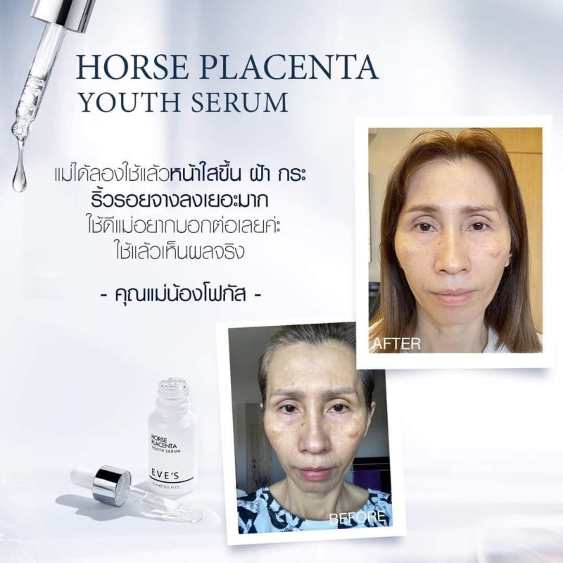 "EVE’S" EVE'S ANTI ACNE CREAM (9 g) - "อีฟส์" แอนตี้ แอคเน่ ครีม 