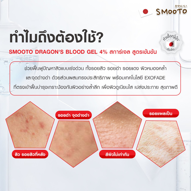 "SMOOTO" Dragon's Blood Acne Bright Booster Gel (20 grams) - "สมูทโตะ" ดราก้อน บลัด 